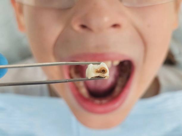 Best Pediatric Emergency Dentist in Brinckerhoff, NY